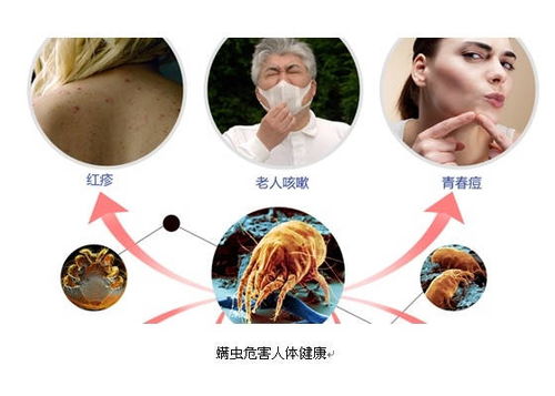 宝宝全身长满红疙瘩,儿科医生确诊,原因竟然是它 