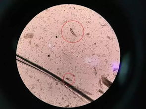肉眼可见的白色螨虫